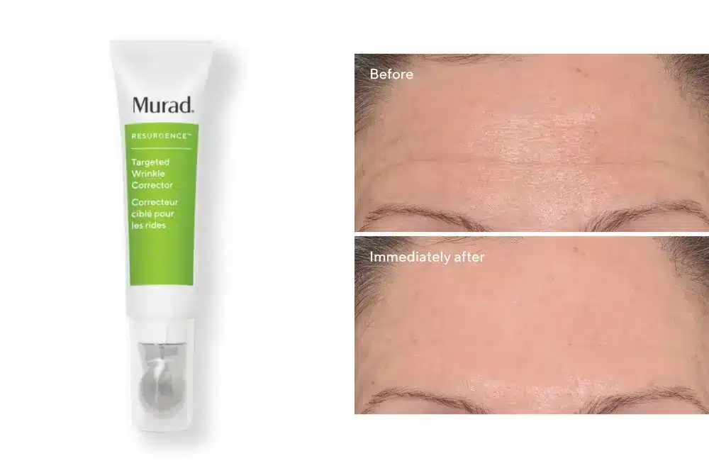 targeted-wrinkle-corrector